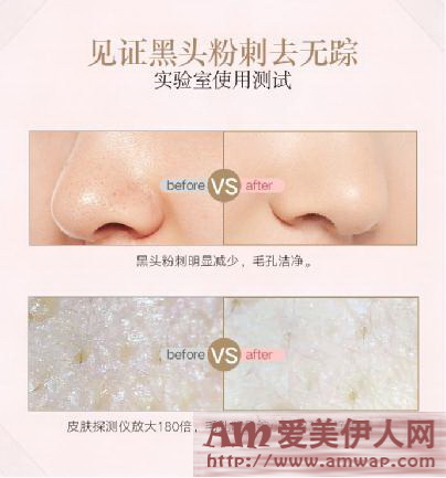 科学对抗PM2.5,温和去黑头粉刺神器 雅萌(YA-MAN)超声波毛孔清洁美容仪全新上市